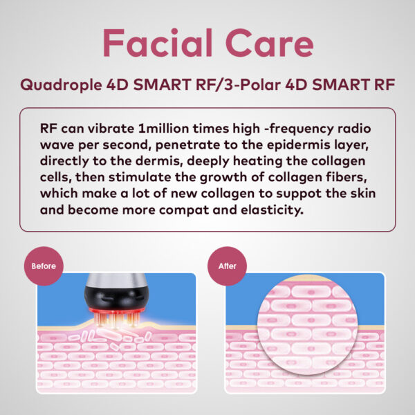 40K 4 IN 1 Ultrasonic Cavitation Radio Frequency Vacuum Machine Body Slimming Sculpting Device