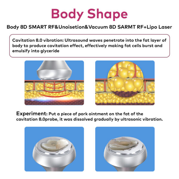 6 IN 1 80K Ultrasonic Cavitation Skin Tightening Machine Anti Cellulite