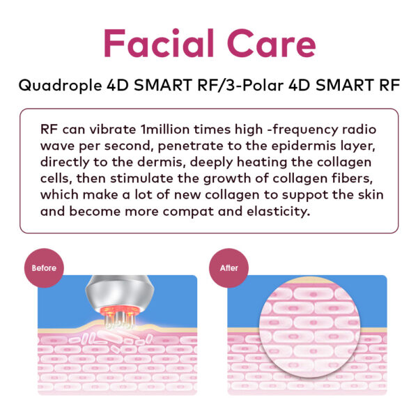 ultrasonic cavitation device skin tightening machine