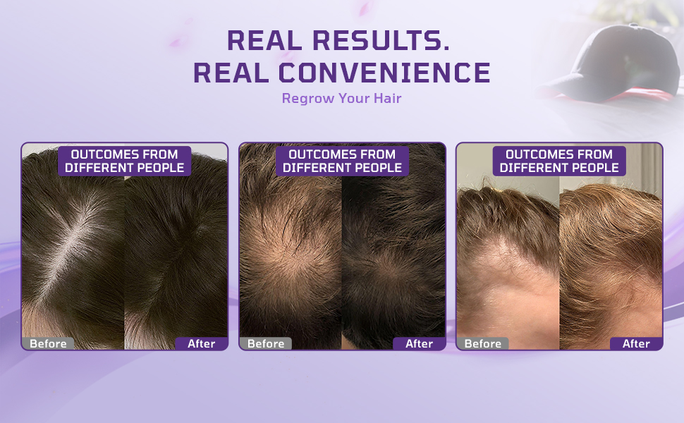 red light therapy for hair growth