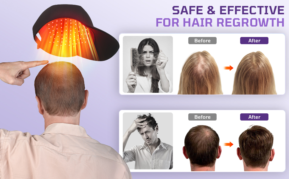 red light therapy for hair growth