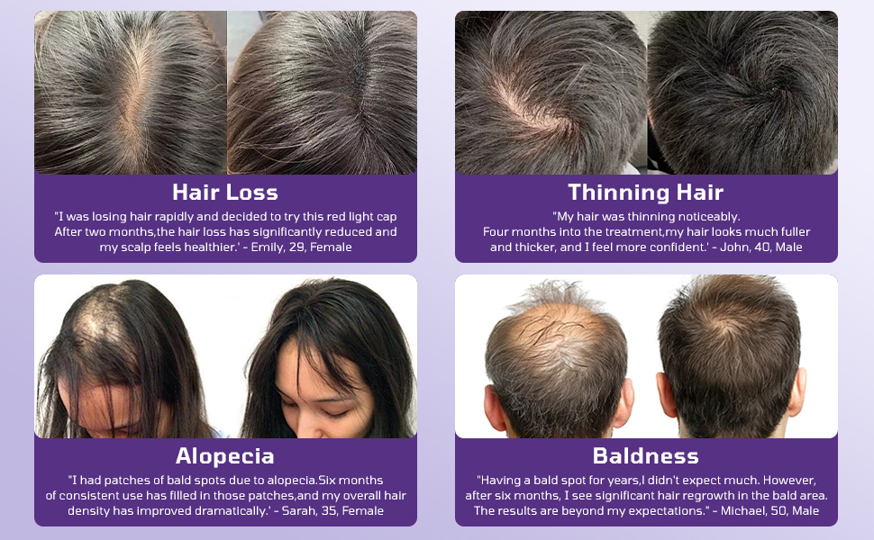 red light therapy for hair growth